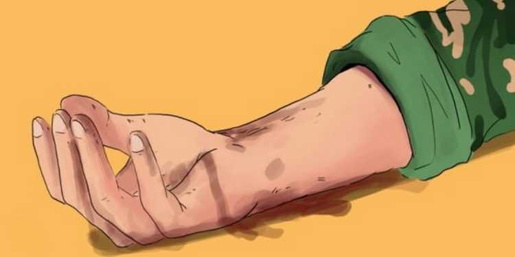 ilustrasi iris pergelangan tangan