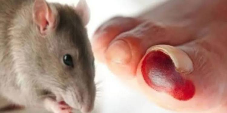 leptospirosis